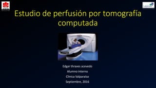 Estudio de perfusión por tomografía
computada
Edgar thraves acevedo
Alumno interno
Clínica Valparaíso
Septiembre, 2016
 