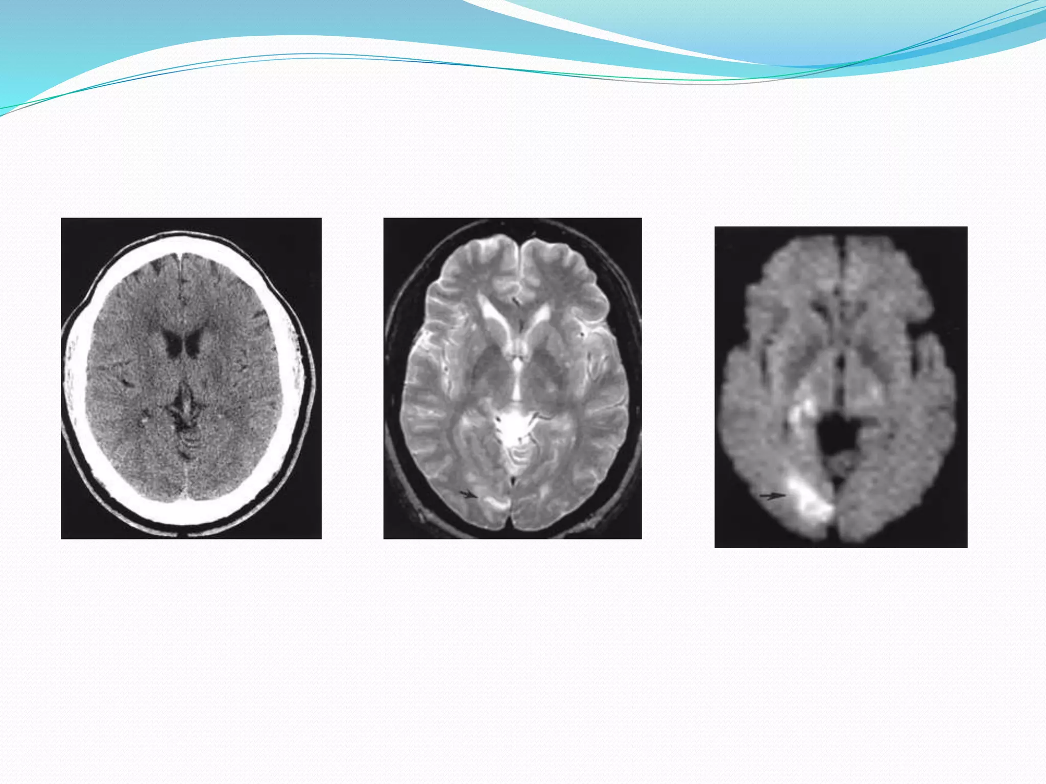 Perfusion and dynamic contrast enhanced mri | PPTX