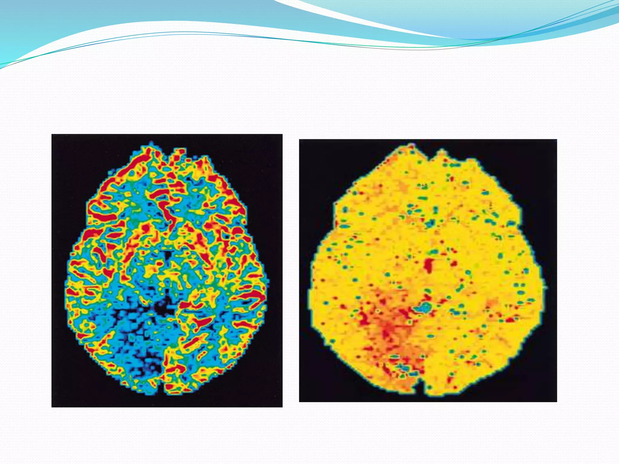 Perfusion and dynamic contrast enhanced mri | PPTX