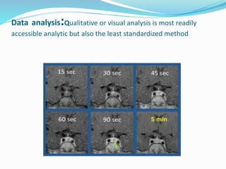 Data analysis:Qualitative or visual analysis is most readily
accessible analytic but also the least standardized method
 