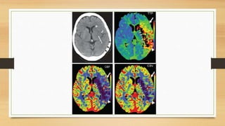 Perfusion MRI (DSC and DCE perfusion techniques) for radiology ...