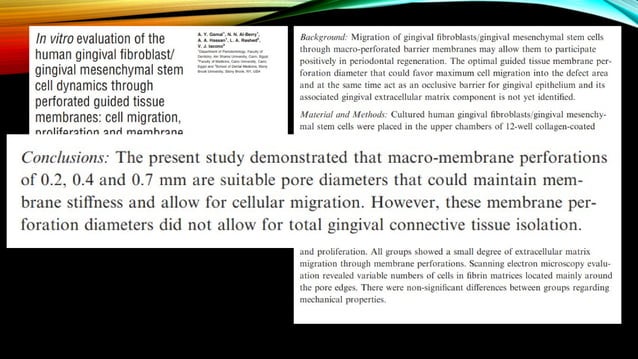 perf vs non perf Seminar periodotology.pptx