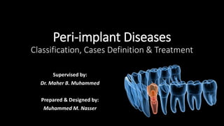 Peri-implant Diseases
Classification, Cases Definition & Treatment
Supervised by:
Dr. Maher B. Muhammed
Prepared & Designed by:
Muhammed M. Nasser
 