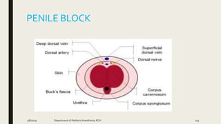 PENILE BLOCK
2/8/2019 Department of PediatricAnesthesia, KCH 103
 
