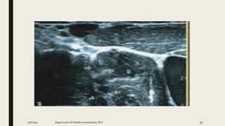 2/8/2019 Department of PediatricAnesthesia, KCH 69
 