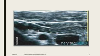 2/8/2019 Department of PediatricAnesthesia, KCH 73
 