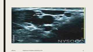 2/8/2019 Department of PediatricAnesthesia, KCH 75
 