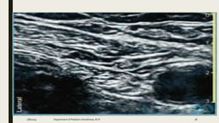 2/8/2019 Department of PediatricAnesthesia, KCH 78
 