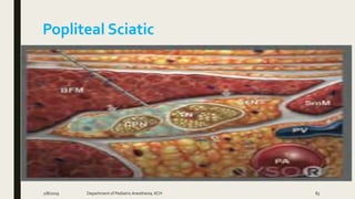Popliteal Sciatic
2/8/2019 Department of PediatricAnesthesia, KCH 83
 