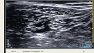 2/8/2019 Department of PediatricAnesthesia, KCH 84
 