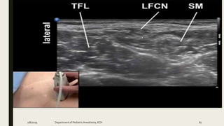 2/8/2019 Department of PediatricAnesthesia, KCH 87
 