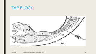 TAP BLOCK
2/8/2019 Department of PediatricAnesthesia, KCH 89
 