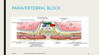 PARAVERTEBRAL BLOCK
2/8/2019 Department of PediatricAnesthesia, KCH 94
 
