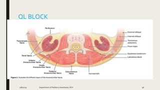 QL BLOCK
2/8/2019 Department of PediatricAnesthesia, KCH 96
 