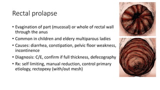 Rectal prolapse
• Evagination of part (mucosal) or whole of rectal wall
through the anus
• Common in children and eldery multiparous ladies
• Causes: diarrhea, constipation, pelvic floor weakness,
incontinence
• Diagnosis: C/E, confirm if full thickness, defecography
• Rx: self limiting, manual reduction, control primary
etiology, rectopexy (with/out mesh)
 