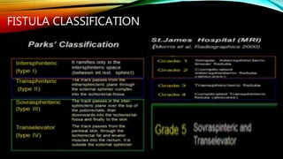 Parks Classification Perianal fistula | PPTX