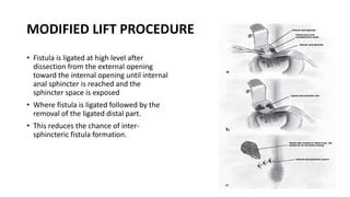 Perianal surgeris.pptx