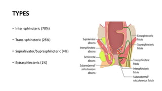 Perianal surgeris.pptx
