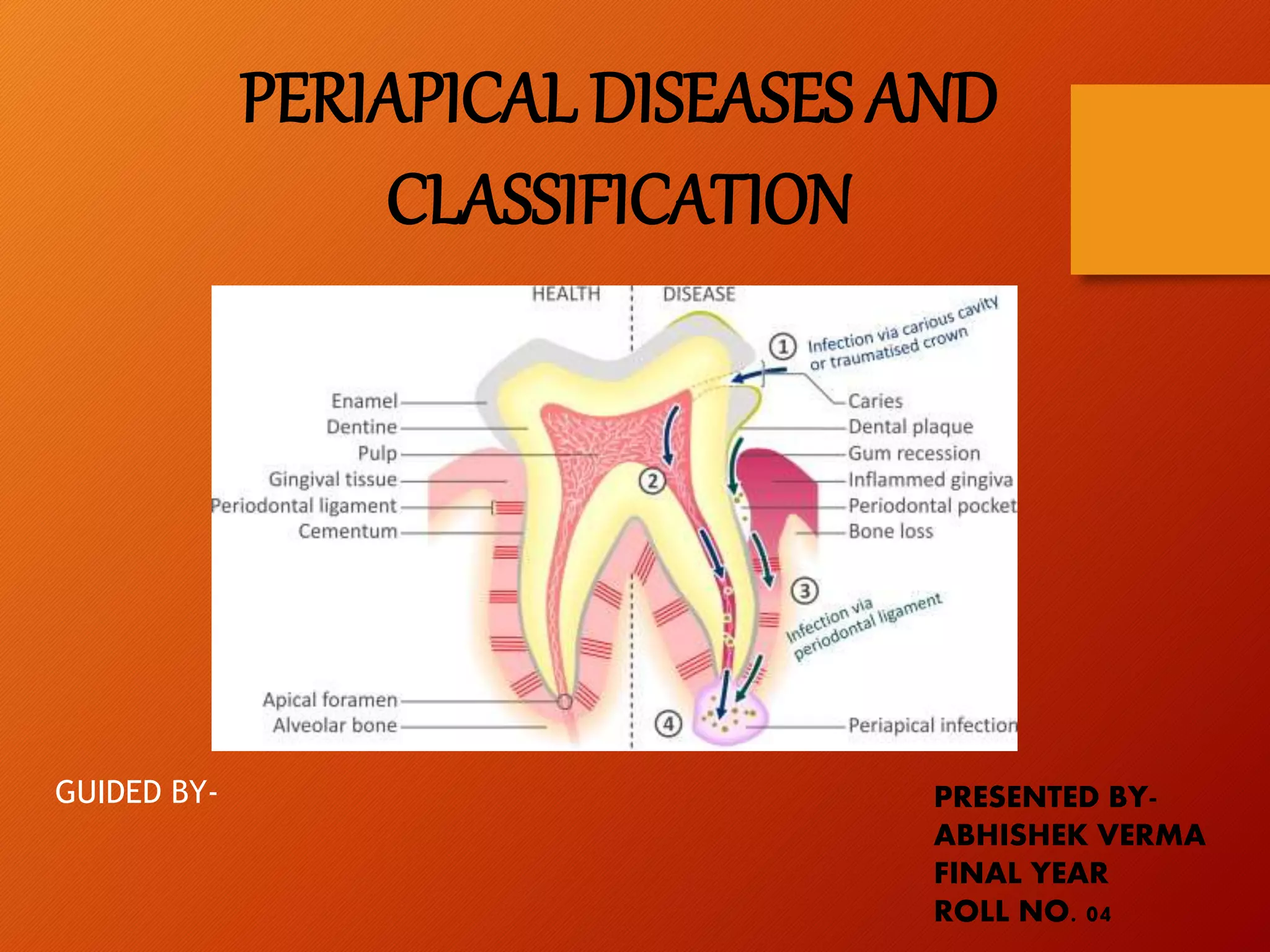 Periapical Radiopacity Classification Periapical diseases and classification | PPTX