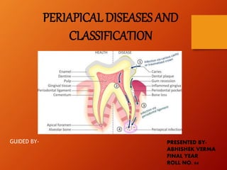 PRESENTED BY-
ABHISHEK VERMA
FINAL YEAR
PCDS & RC, BHOPAL
PERIAPICAL DISEASES AND
CLASSIFICATION
 