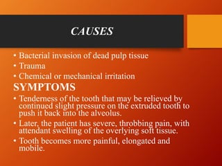 CAUSES
• Bacterial invasion of dead pulp tissue
• Trauma
• Chemical or mechanical irritation
SYMPTOMS
• Tenderness of the ...