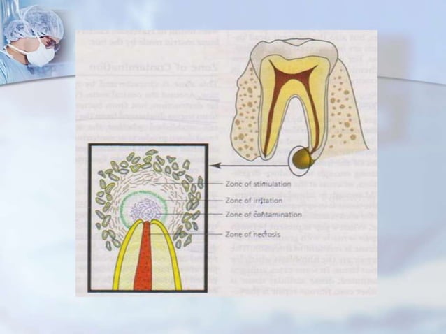 Periapical pathology | PPTX