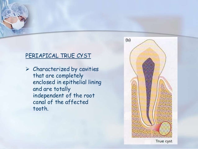 periapical pathology apical scar