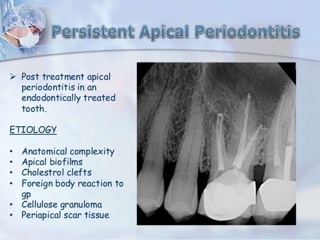 periapical pathology apical scar