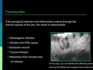 Osteomyelitis
If the periapical infection and inflammation extend through the
marrow spaces of the jaw, the result is osteomyelitis.
 Odontogenic infection
 Infection thro PDL space
 Extraction wound
 Trauma-fracture
 Metastasis from remote area
of infection
In this case, you can identify the offending tooth
causing the diffuse and irregular bone destructio
 
