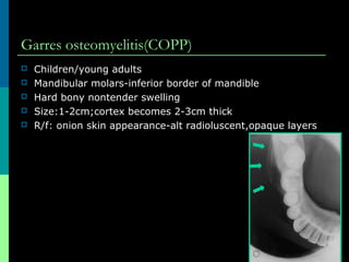 Garres osteomyelitis(COPP)
 Children/young adults
 Mandibular molars-inferior border of mandible
 Hard bony nontender swelling
 Size:1-2cm;cortex becomes 2-3cm thick
 R/f: onion skin appearance-alt radioluscent,opaque layers
 