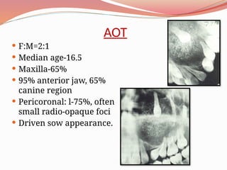 Periapical Radiopacity Classification periapical & pericoronal radiopacity.pptx