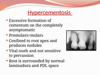 Hypercementosis Roots Radiograph periapical & pericoronal radiopacity.pptx