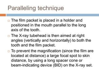 Periapical radiograph | PPTX