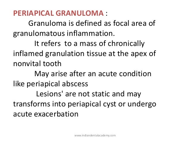 Periapical radiolucencies./ oral surgery courses Periapical radiolucencies./ oral surgery courses