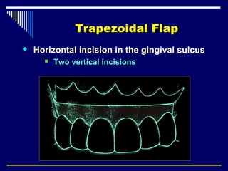 Trapezoidal Incision Periapical surgery | PPT