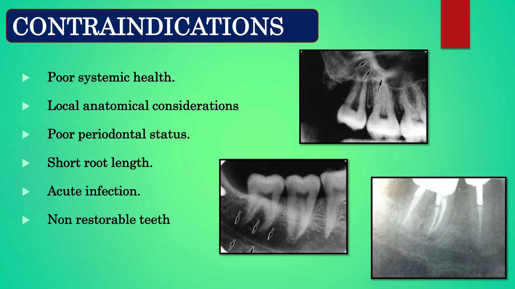  Poor systemic health.
 Local anatomical considerations
 Poor periodontal status.
 Short root length.
 Acute infection.
 Non restorable teeth
CONTRAINDICATIONS
 