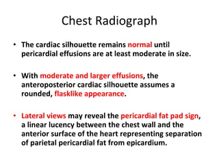 Chest Radiograph The cardiac silhouette remains  normal  until pericardial effusions are at least moderate in size. With  moderate and larger effusions , the anteroposterior cardiac silhouette assumes a rounded,  flasklike appearance . Lateral views  may reveal the  pericardial fat pad sign , a linear lucency between the chest wall and the anterior surface of the heart representing separation of parietal pericardial fat from epicardium. 