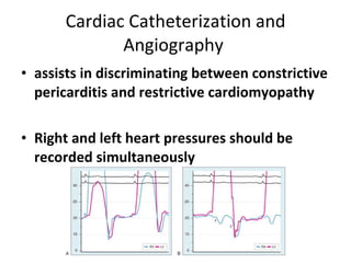 Cardiac Catheterization and Angiography  assists in discriminating between constrictive pericarditis and restrictive cardiomyopathy Right and left heart pressures should be recorded simultaneously  