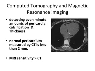 Computed Tomography and Magnetic Resonance Imaging detecting even minute amounts of pericardial calcification  & Thickness normal pericardium measured by CT is less than 2 mm. MRI sensitivity > CT 
