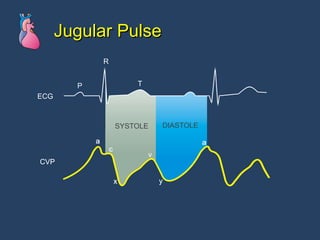 Jugular Pulse 