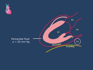 Pericardial Fluid p = 20 mm Hg 