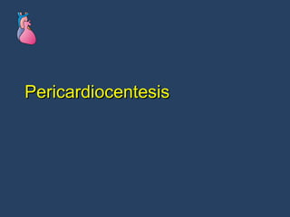 Pericardiocentesis 