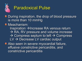 Paradoxical Pulse During inspiration, the drop of blood pressure is more than 10 mmHg  Meachanism:   Inspiration   Increase RA venous return     RA, RV pressure and volume increase     Compress septum to left    Compress   LV    Decrease LV cardiac output  Also seen in severe myocardial failure, effusive constrictive pericarditis, and  constrictive pericarditis  