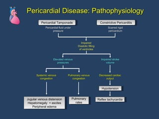 Pericardial Disease: Pathophysiology Pericardial Tamponade Constrictive Pericarditis Jugular venous distension Hepatomegaly  = ascites Peripheral edema Pulmonary rales Reflex tachycardia Hypotension Pericardial fluid under pressure Scarred rigid pericardium Impaired Diastolic filling of ventricles Elevated venous pressures Impaired stroke volume Systemic venous congestion Pulmonary venous congestion Decreased cardiac output 