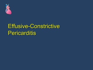 Effusive-Constrictive Pericarditis 