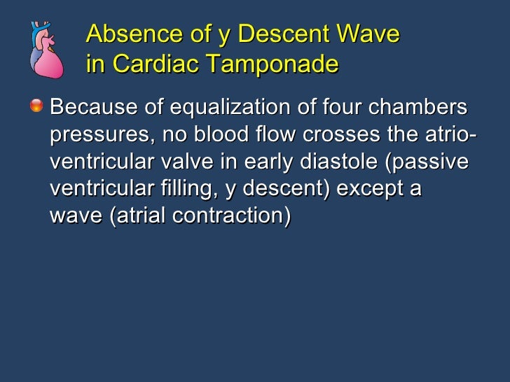 Pericardial Dse Cath Lab