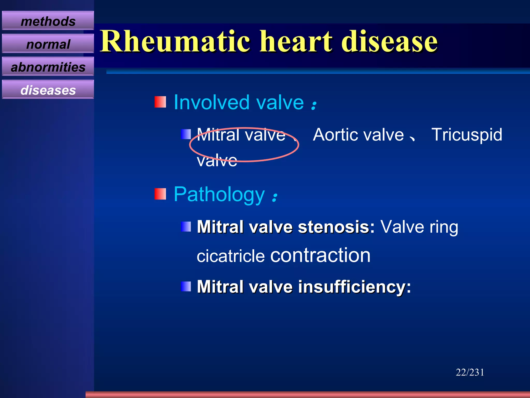 Rheumatic heart disease Involved valve ： Mitral valve 、 Aortic valve 、 Tricuspid valve Pathology ： Mitral valve stenosis :  Valve ring cicatricle  contraction Mitral valve insufficiency : /231 methods normal abnormities diseases 