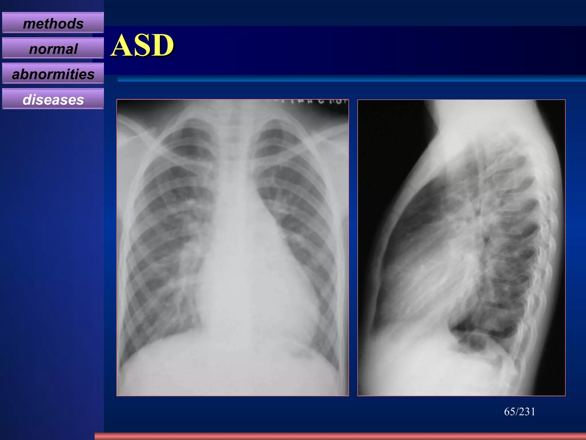 ASD /231 methods normal abnormities diseases 