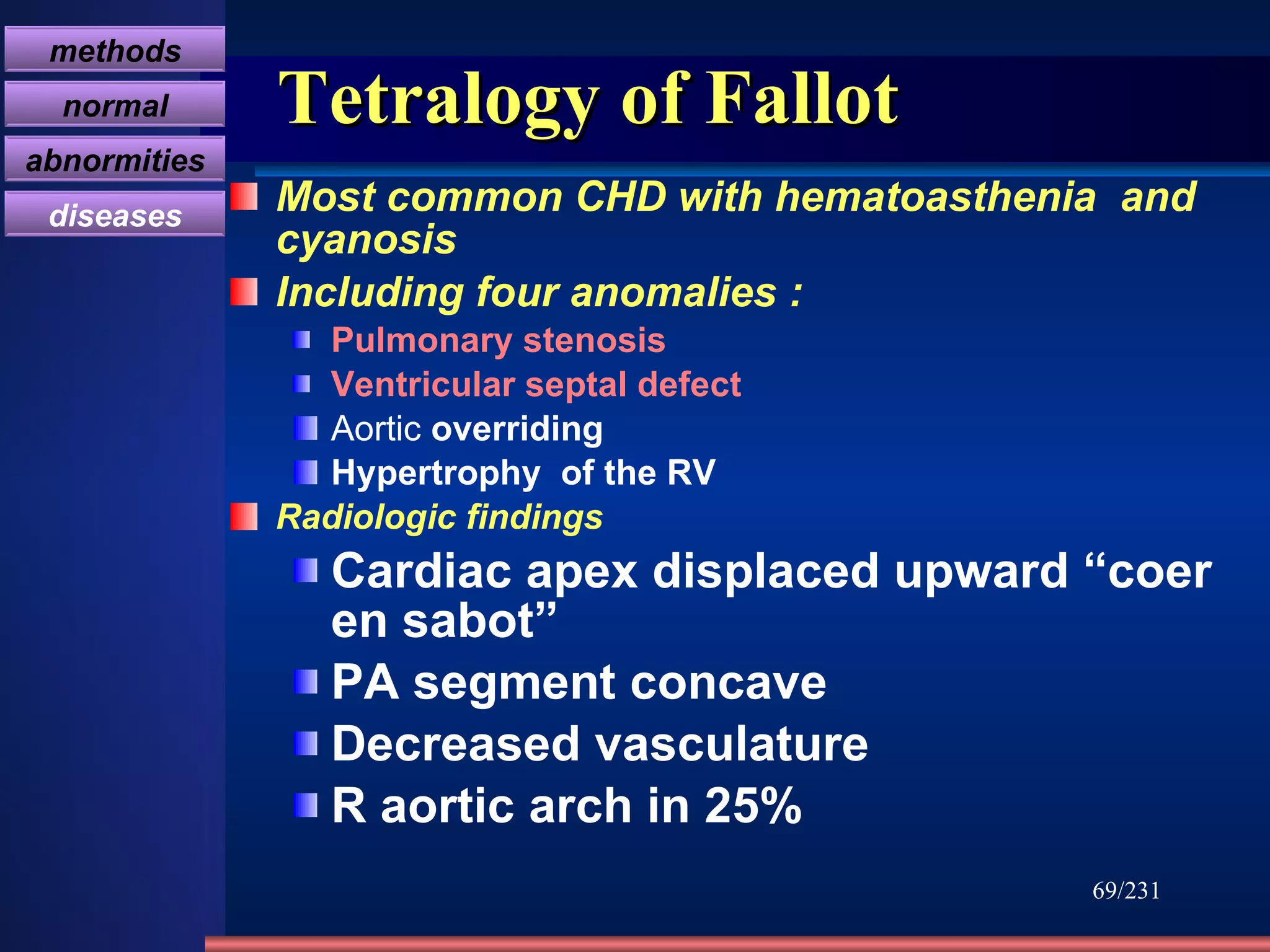 Tetralogy of Fallot Most common CHD with hematoasthenia  and cyanosis  Including four anomalies   : Pulmonary stenosis Ventricular septal defect Aortic  overriding Hypertrophy  of the RV Radiologic findings Cardiac apex displaced upward “coer  en sabot”  PA segment concave  Decreased vasculature  R aortic arch in 25% /231 methods normal abnormities diseases 
