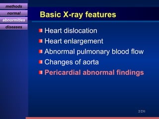 Basic X-ray features Heart dislocation Heart enlargement Abnormal pulmonary blood flow Changes of aorta Pericardial abnormal findings /231 methods normal abnormities diseases 